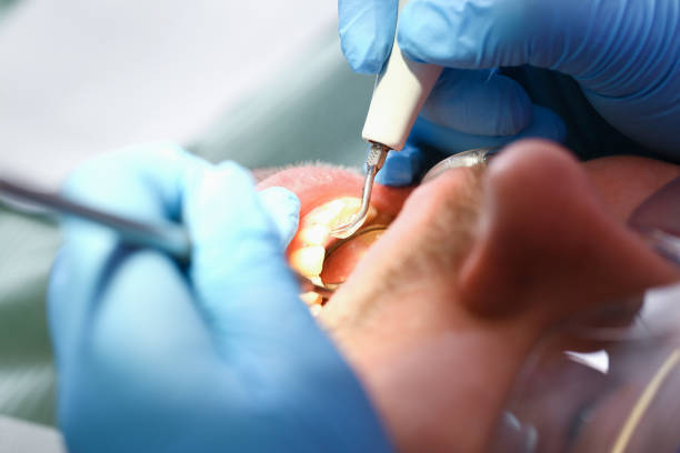 Best Urgent Dental Care for Toothaches in Alamo Heights, TX