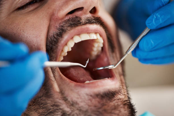 Best Broken or Chipped Tooth Repair in Alamo Heights, TX